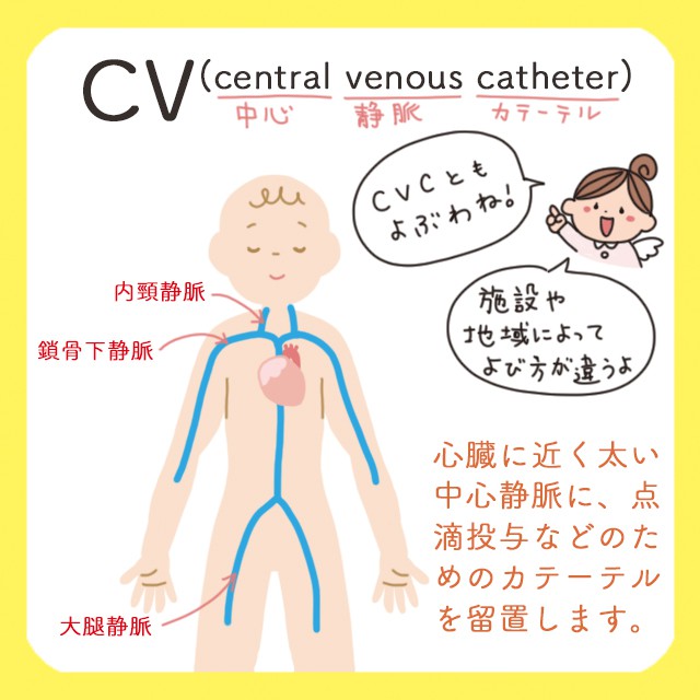 Cvとivhとtpn あれ これって何がちがうの ちゃんと答えられるかな コタエンジェルのハテナース解説講座 Vol 2 レバウェル看護 お役立ち情報