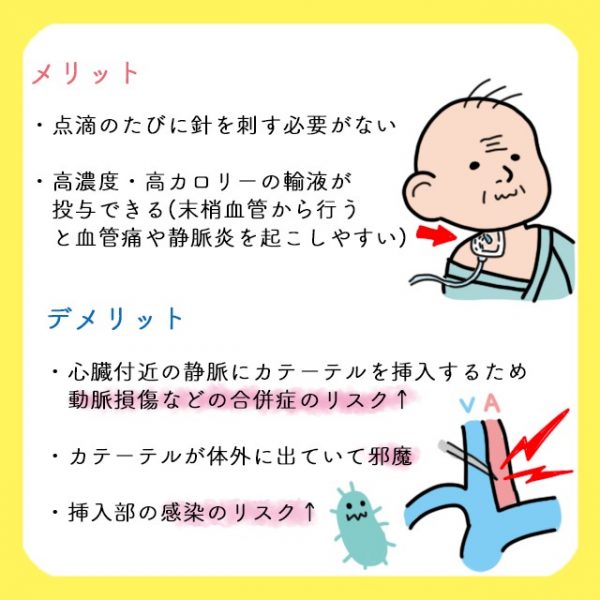 Cvカテーテルとcvポート どう違うの それぞれの適応 メリット デメリットを解説 コタエンジェルのハテナース解説講座 Vol 26 レバウェル看護 お役立ち情報