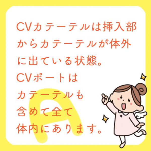 Cvカテーテルとcvポート どう違うの それぞれの適応 メリット デメリットを解説 コタエンジェルのハテナース解説講座 Vol 26 レバウェル看護 お役立ち情報
