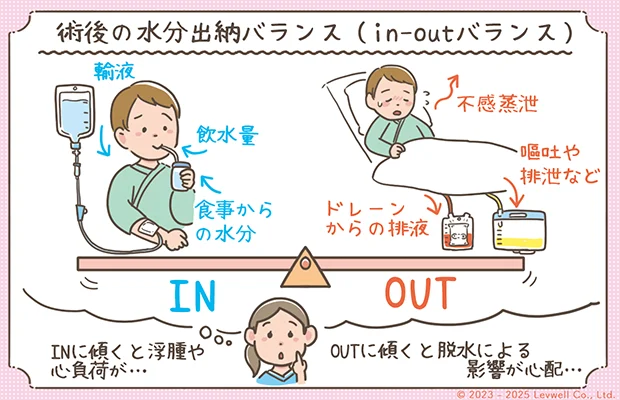 術後の水分出納バランスの解説イラスト