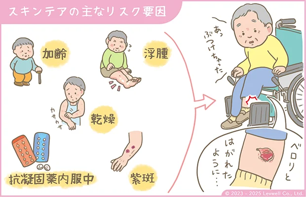 スキンテアの主なリスク要因のイラスト