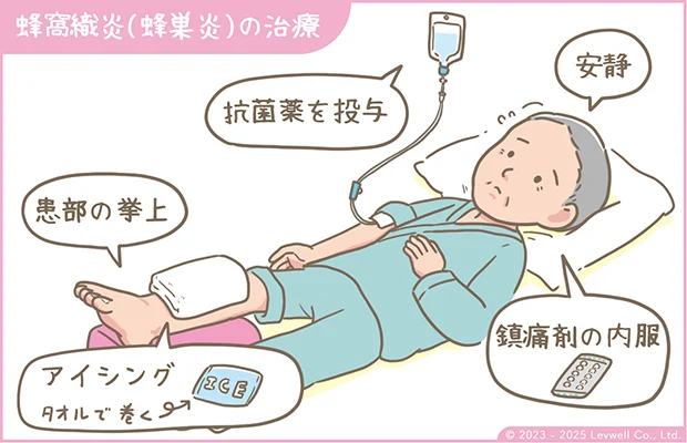 蜂窩織炎の治療方法の解説イラスト