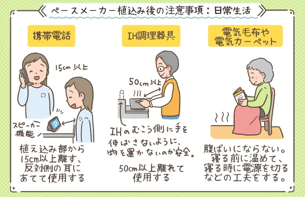 ペースメーカー植込み後の日常生活の注意事項