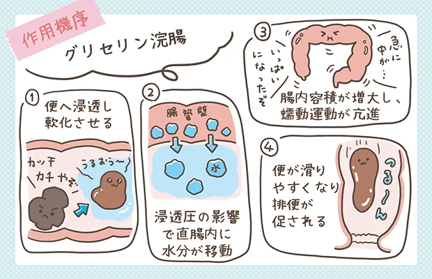 グリセリン浣腸の作用機序の解説イラスト