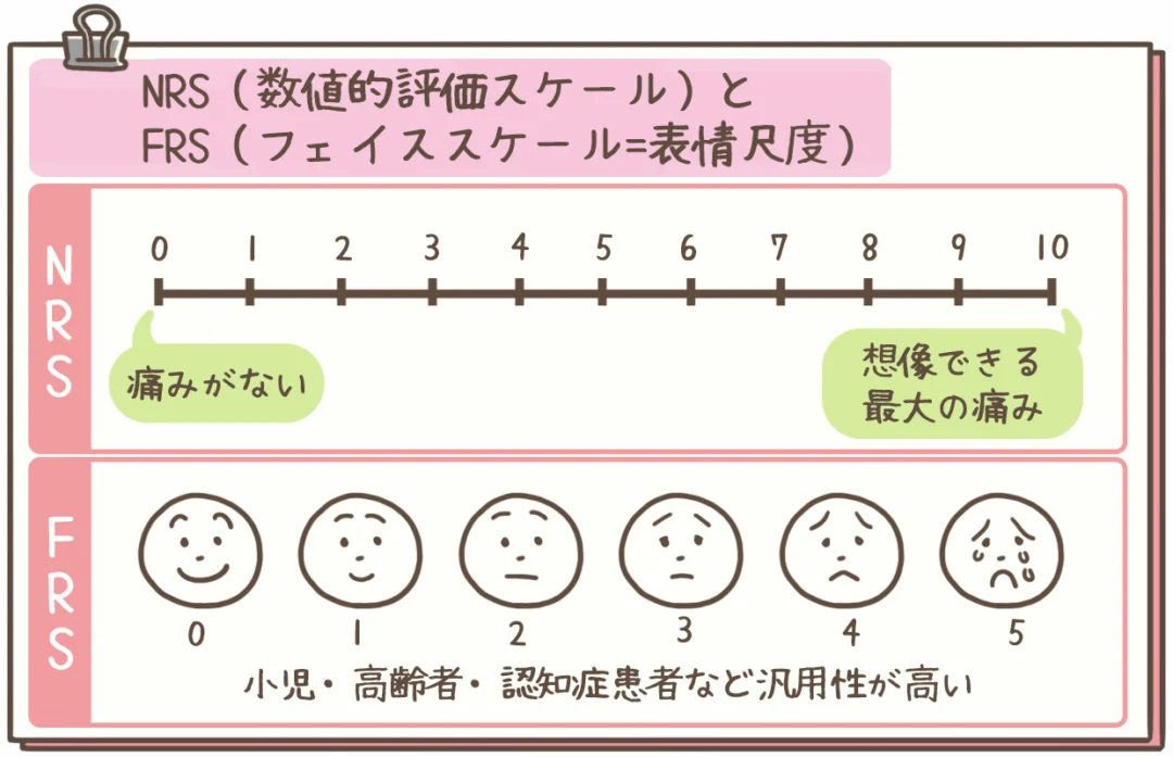 NRS（数値的評価スケール）とFRS（フェイススケール＝表情尺度）について