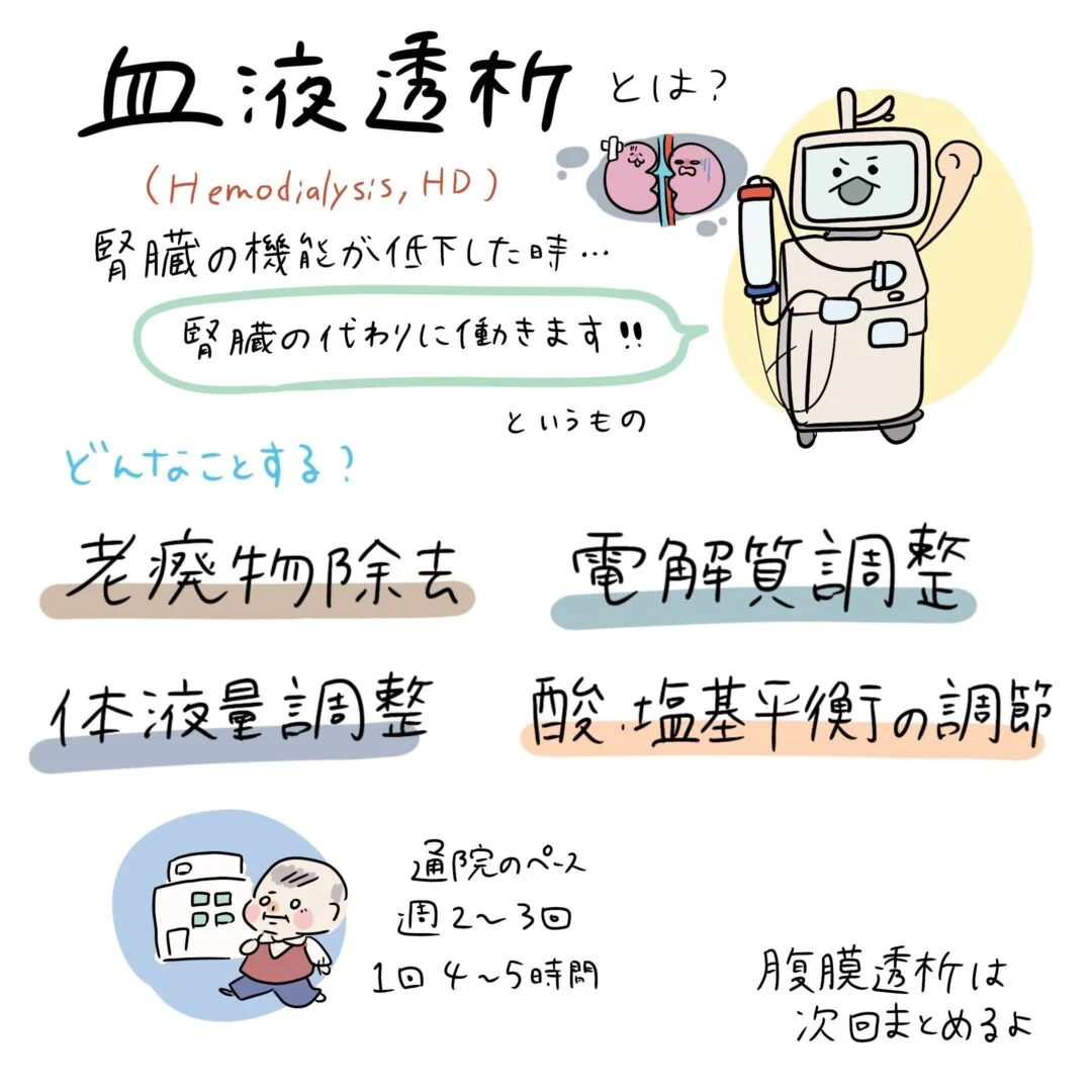 血液透析の解説イラスト