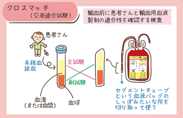 クロスマッチ(交差適合試験)の方法の解説