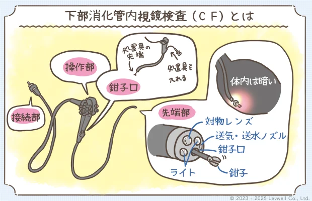 下部消化管内視鏡検査（CF）の解説イラスト