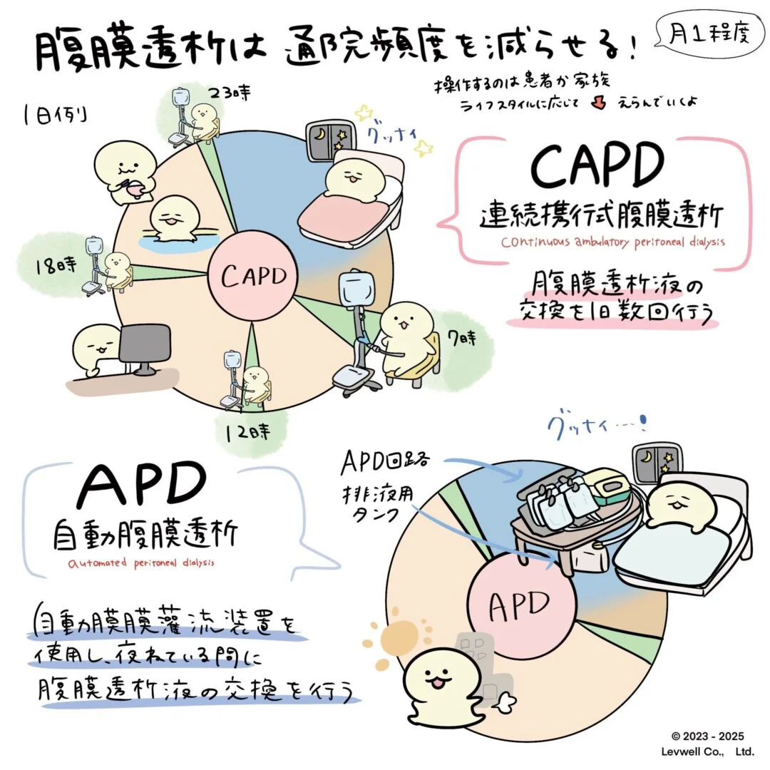 腹膜透析の種類のイラスト