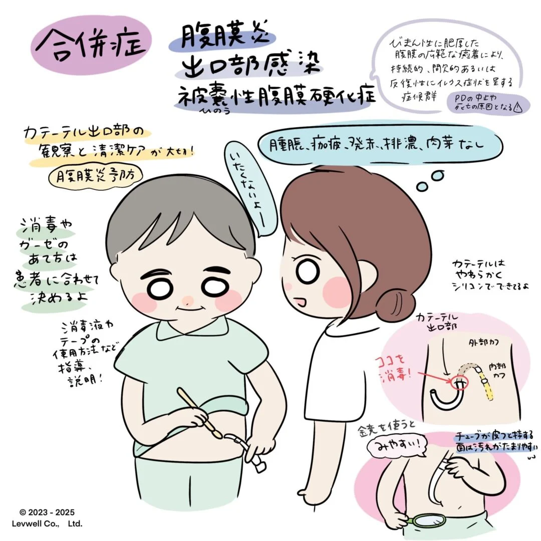 腹膜透析の合併症のイラスト