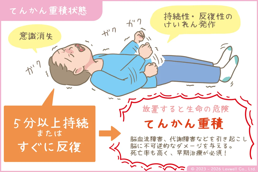 てんかん重積状態の解説イラスト
