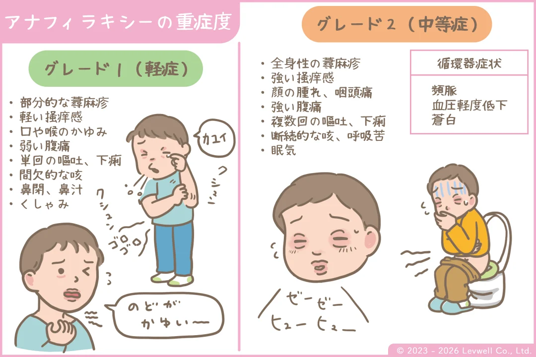 アナフィラキシーの重症度のイラスト