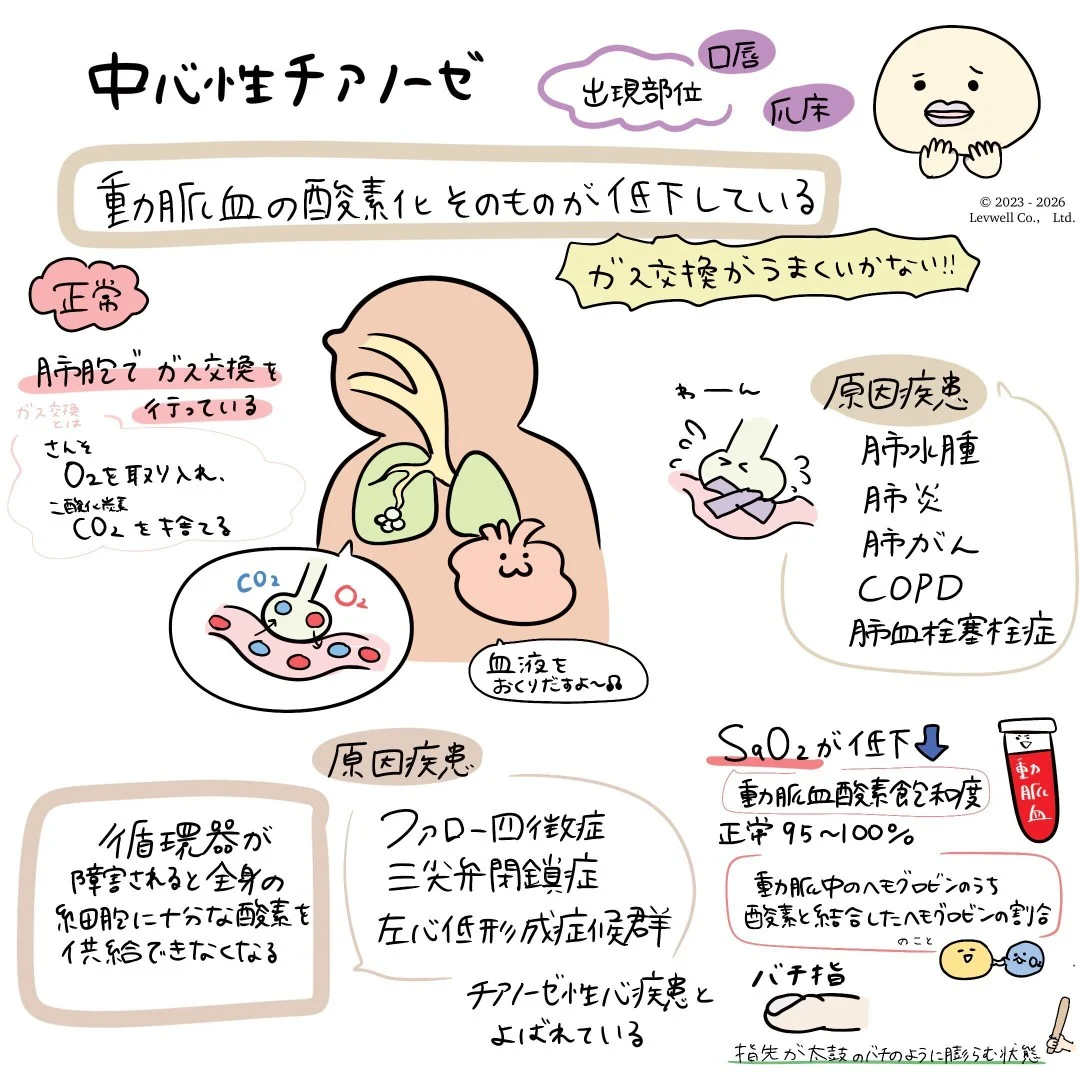 中心性チアノーゼについてのイラスト