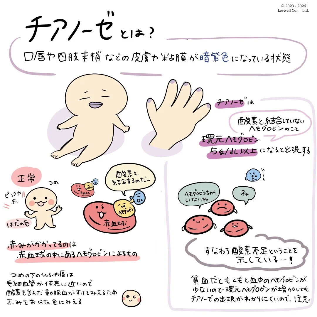 チアノーゼについてのイラスト