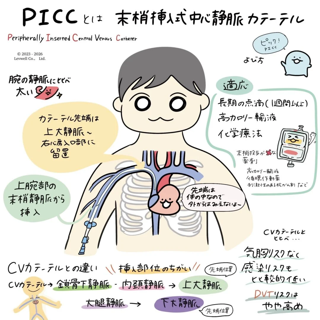 PICCについての解説イラスト