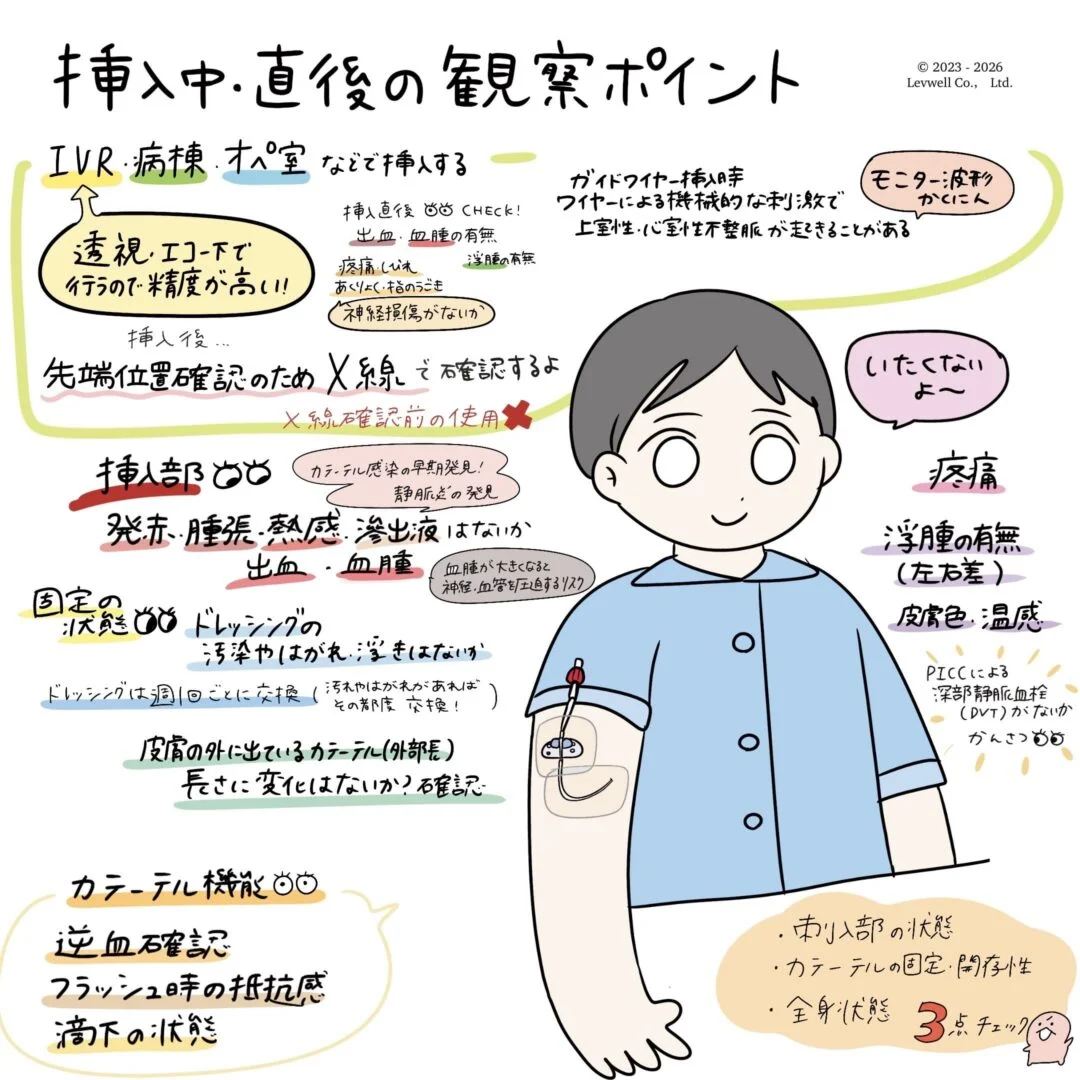 PICC挿入中・直後の観察ポイントについてのイラスト