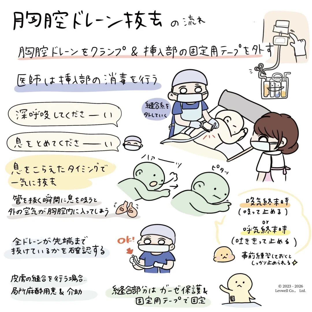 胸腔ドレーン抜去の流れについての解説イラスト